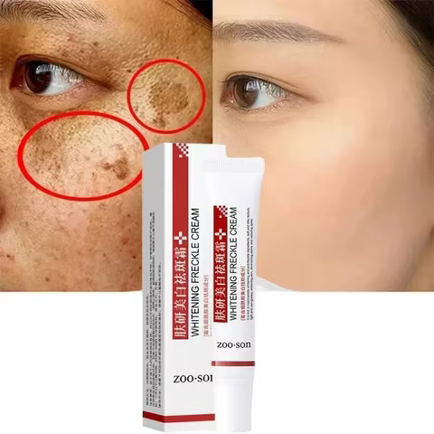 12 best sales hyperpigmentation - №6