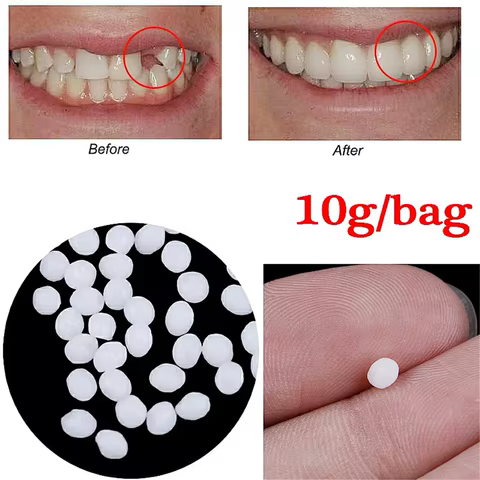 10g/Bag Tooth Repair Kit-Thermal Beads for Filling Fix The Missing and Broken Tooth or Adhesive The Denture Fake Teeth 10 best sales tooth filler - №1