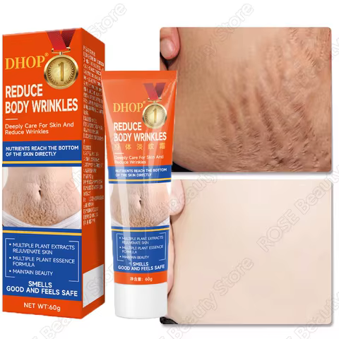 Stretch Marks Permanent Removal Cream Maternity Pregnant Women Pregnancy Anti-Winkle Smooth Repair Firming Skin Body Skin Care 8 best sales stretch mark removal - №3