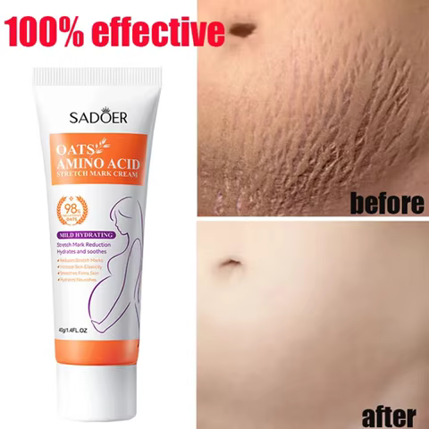 Stretch Marks Permanent Removal Cream Eliminate Body Belly Stretch Marks Swelling Marks Remove Skin Cracks Repair Firming Care 8 best sales stretch mark removal - №1