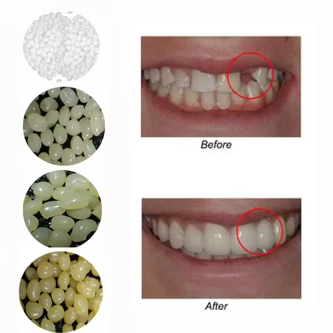 4 Colors Dental Oral False Fake Teeth Tooth Filling Repair Smile Snap on Veneers Dentures Case Paste Adhesive Beads Cosmetic 10 best sales tooth filler - №9
