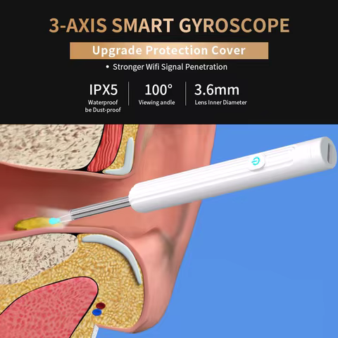 Smart Visual Ear Cleaner with Camera 1296P Ear Sticks USB C Charging Ear Wax Removal Tool WIFI Connection 6 LED Lights Earpick 12 best sales propolis serum - №7