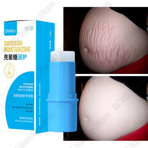 Removes Stretch Mark Stick Cream Pregnant Women Repair Anti-Aging Anti-Winkles Cream Increase Elasticity Smooth Firm Skin Care 8 best sales stretch mark removal - №5