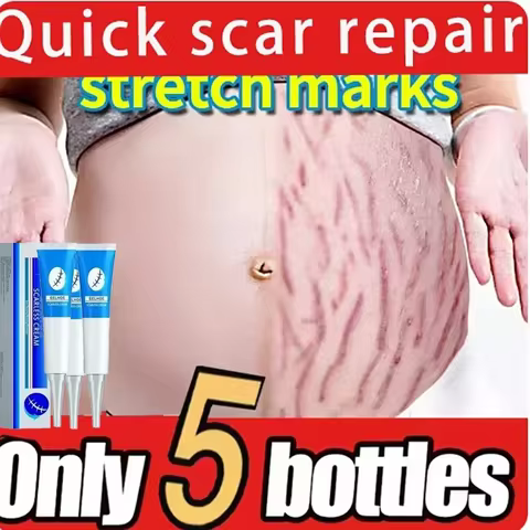 Eliminate Red White Old Stretch Marks Cream For Pregnancy Postpartum Skin Care 8 best sales stretch mark removal - №6