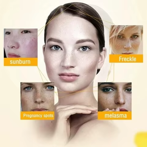 12 best sales hyperpigmentation - №6